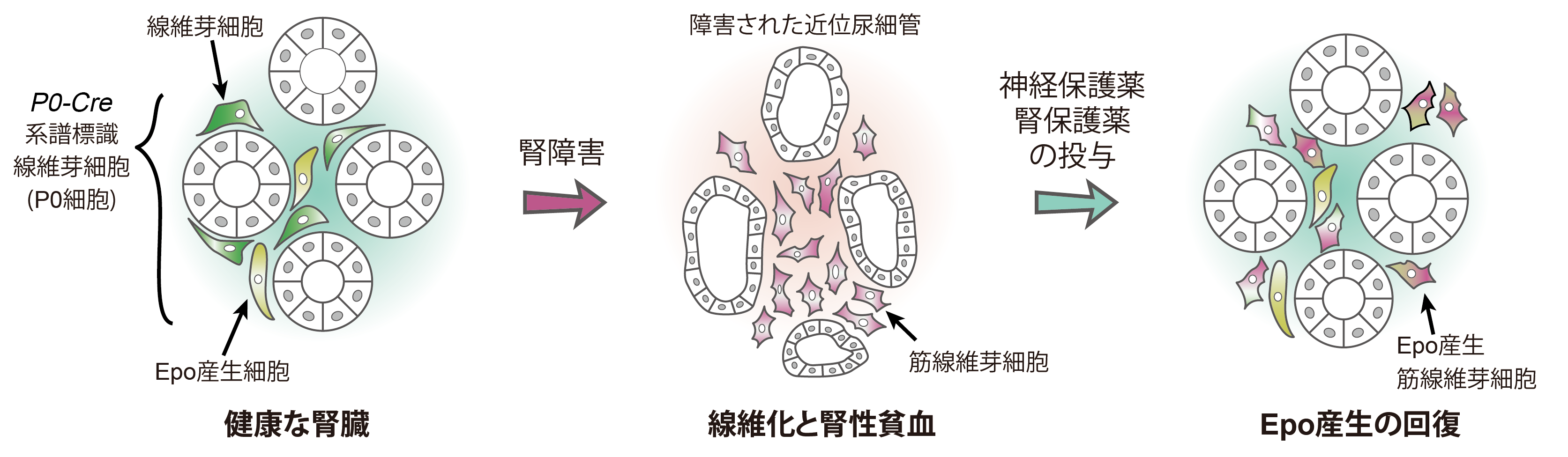 腎臓病が進行した際の共通所見である線維化と腎性貧血のメカニズム