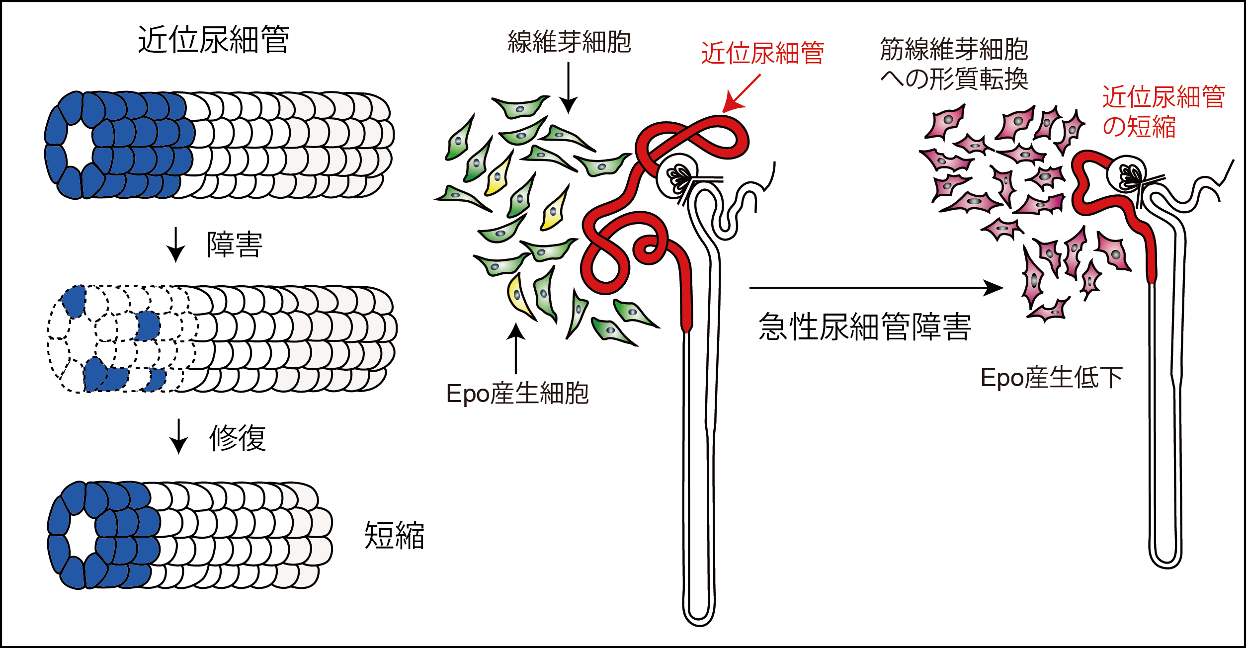 急性腎障害からの回復メカニズム