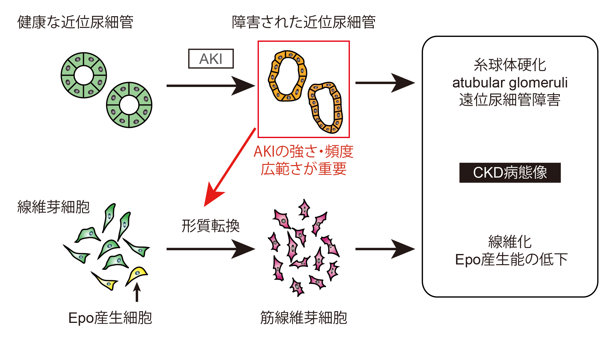 急性腎障害から慢性腎臓病へと移行するメカニズム